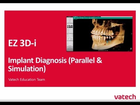 Implant Diagnosis (Parallel Simulation with Markers)