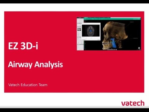 Airway Analysis